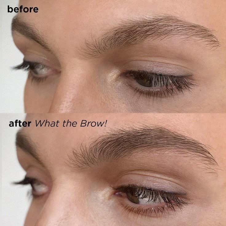 Customized Brows Growth Treatment