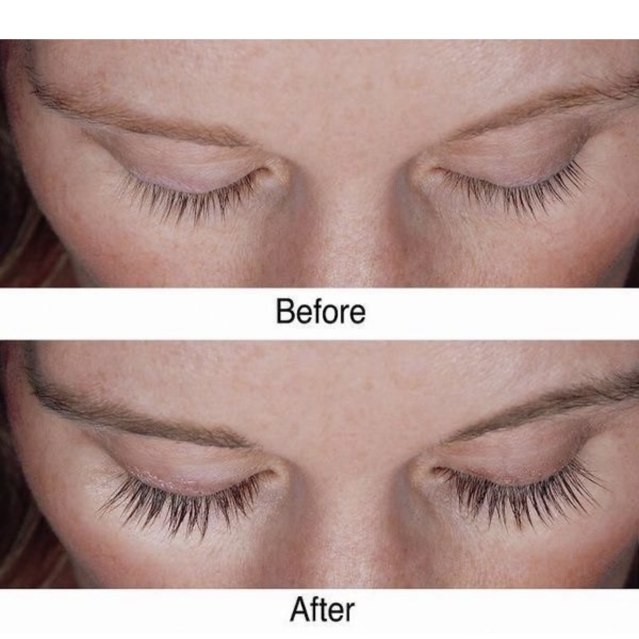 Customized Eyelash Growth Treatment